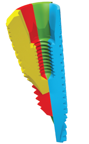 medical next implantes conex conica